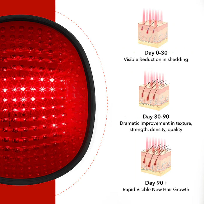 Grow 272 Laser Hair Therapy Cap – Clinically Proven Hair Regrowth