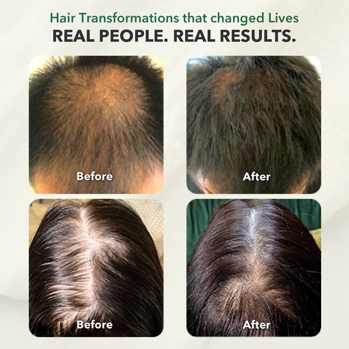 H5 Hair Growth+ Vitamin – Advanced Hair Strength & Regrowth Formula; 90 capsules