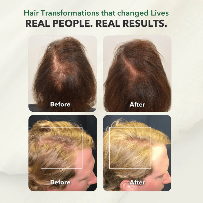 HairSmart RSH Therapy Shampoo: Ayurvedic Gentle Cleanser, 300 ml