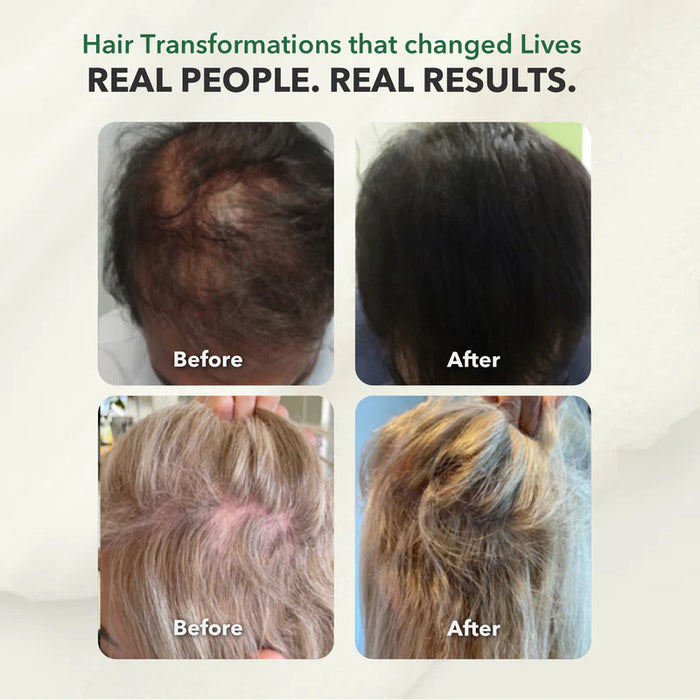 HairSmart Combo: Ayurvedic 2-Step Root & Scalp Therapy