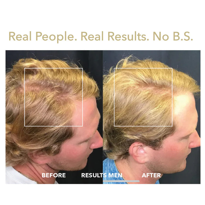 Grow 272 Laser Hair Therapy Cap – Clinically Proven Hair Regrowth