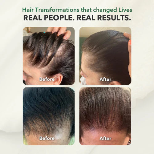 Essential For Hair w/Serum: For Density